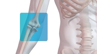 Distal Biceps Repair with Arthrex Tension Slide